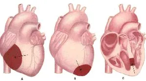 Εντοπισμός βλάβης