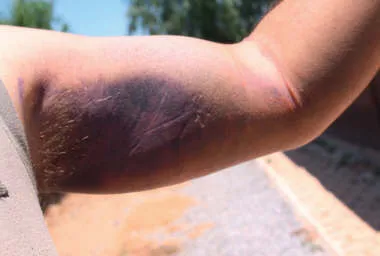 Συμπτώματα