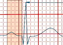 ECG PR interval