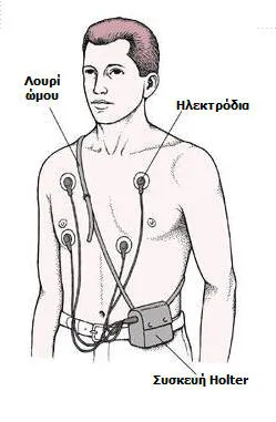 Συσκευή Holter
