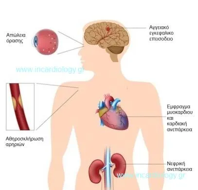 Επιπλοκές Υπέρτασης