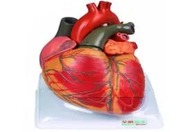 Αρτηριακή υπέρταση