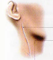 Διάταση τραχηλικών φλεβών