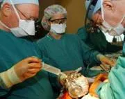 Χειρουργική μυεκτομή σε υπερτροφική μυοκαρδιοπάθεια